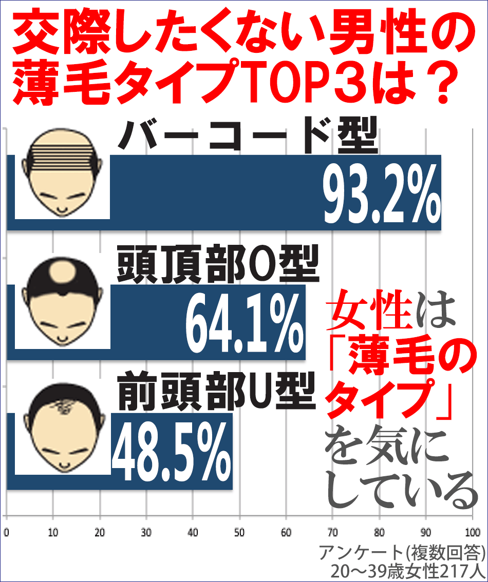 女性に人気のない薄毛タイプNo1はバーコード型