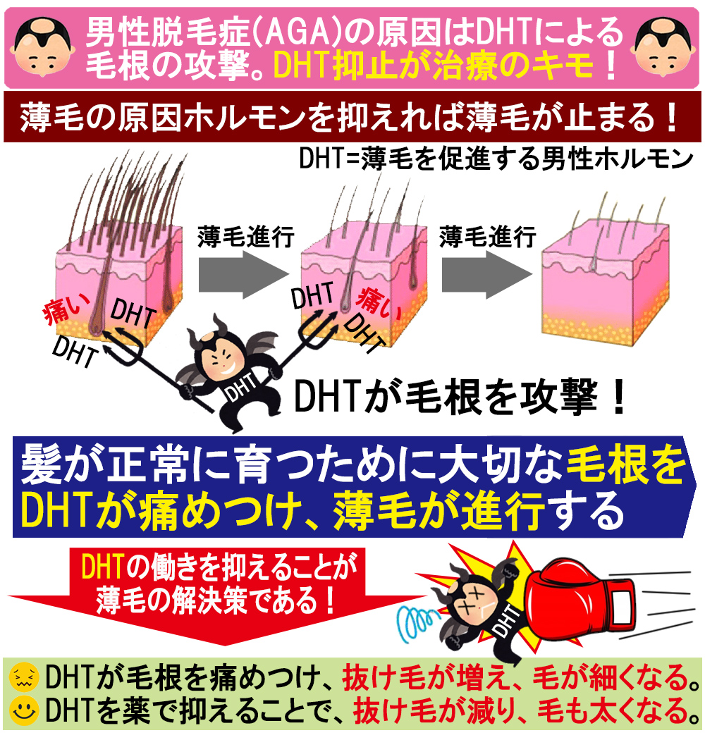 薄毛の原因はDHTという男性ホルモン
