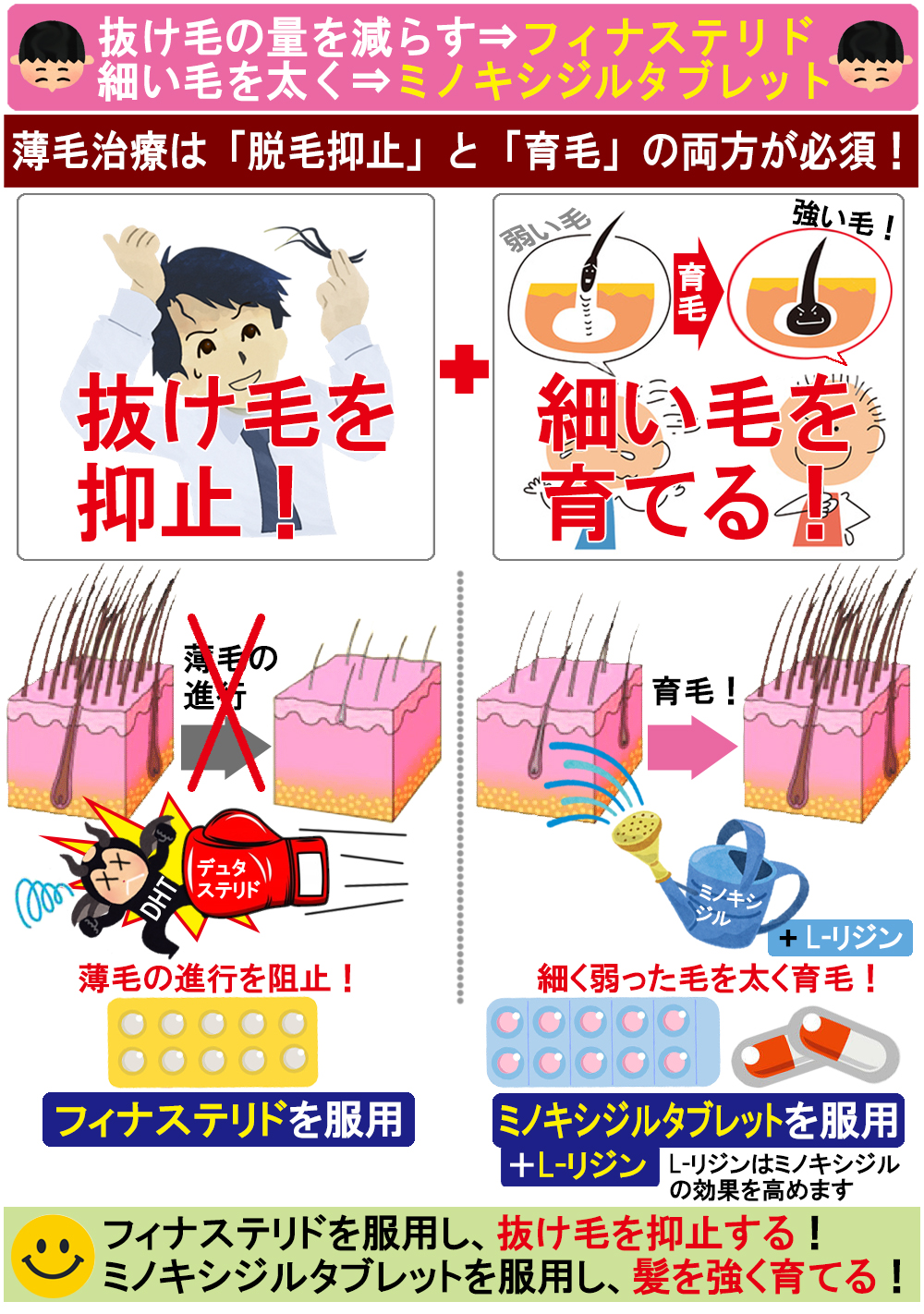 薄毛の治療はフィナステリドとミノキシジルタブレット