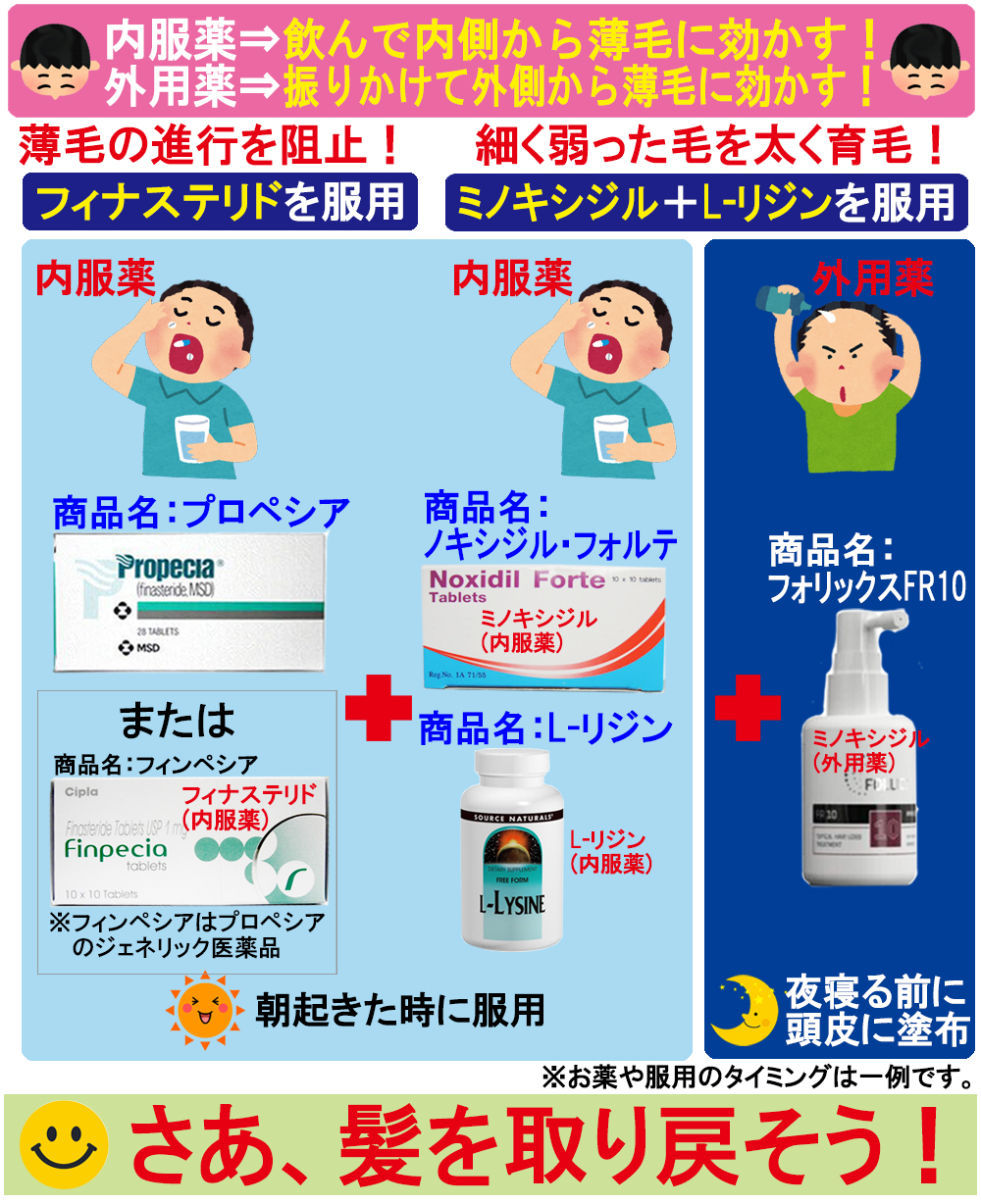薄毛の治療は、プロペシア、フィンペシア、、ミノキシジルタブレット、フォリックスFR10