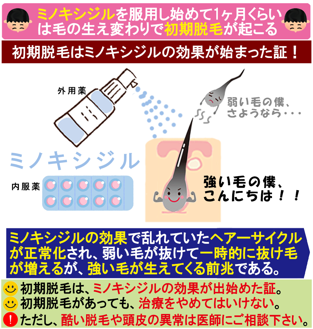ミノキシジル服用し始めの初期脱毛について
