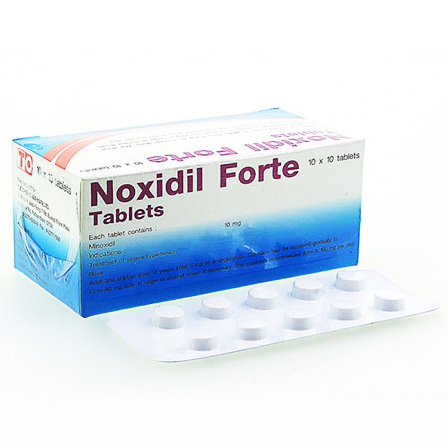 ミノキシジルタブレット